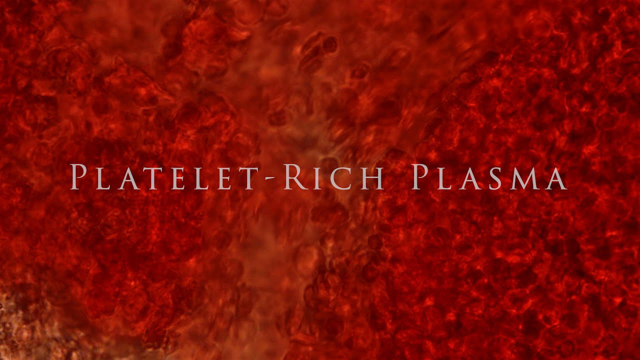 Platelet-Rich Plasma